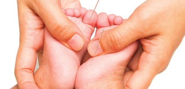 acupuntura em bebês